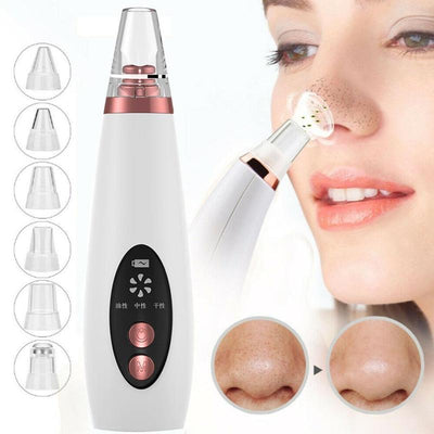 Blackhead pore vacuum cleaner with multiple suction heads for effective nose blackhead removal and skin care.